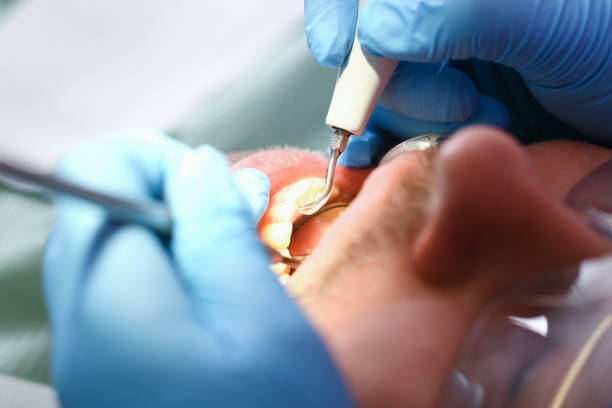 Best Emergency Denture Repair in North Charleston, SC